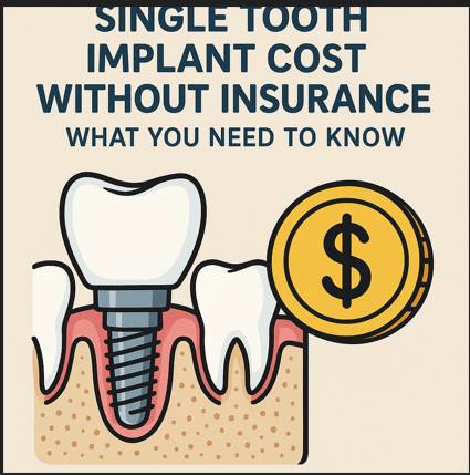 Single Tooth Implant Cost Without Insurance: What You Need to Know